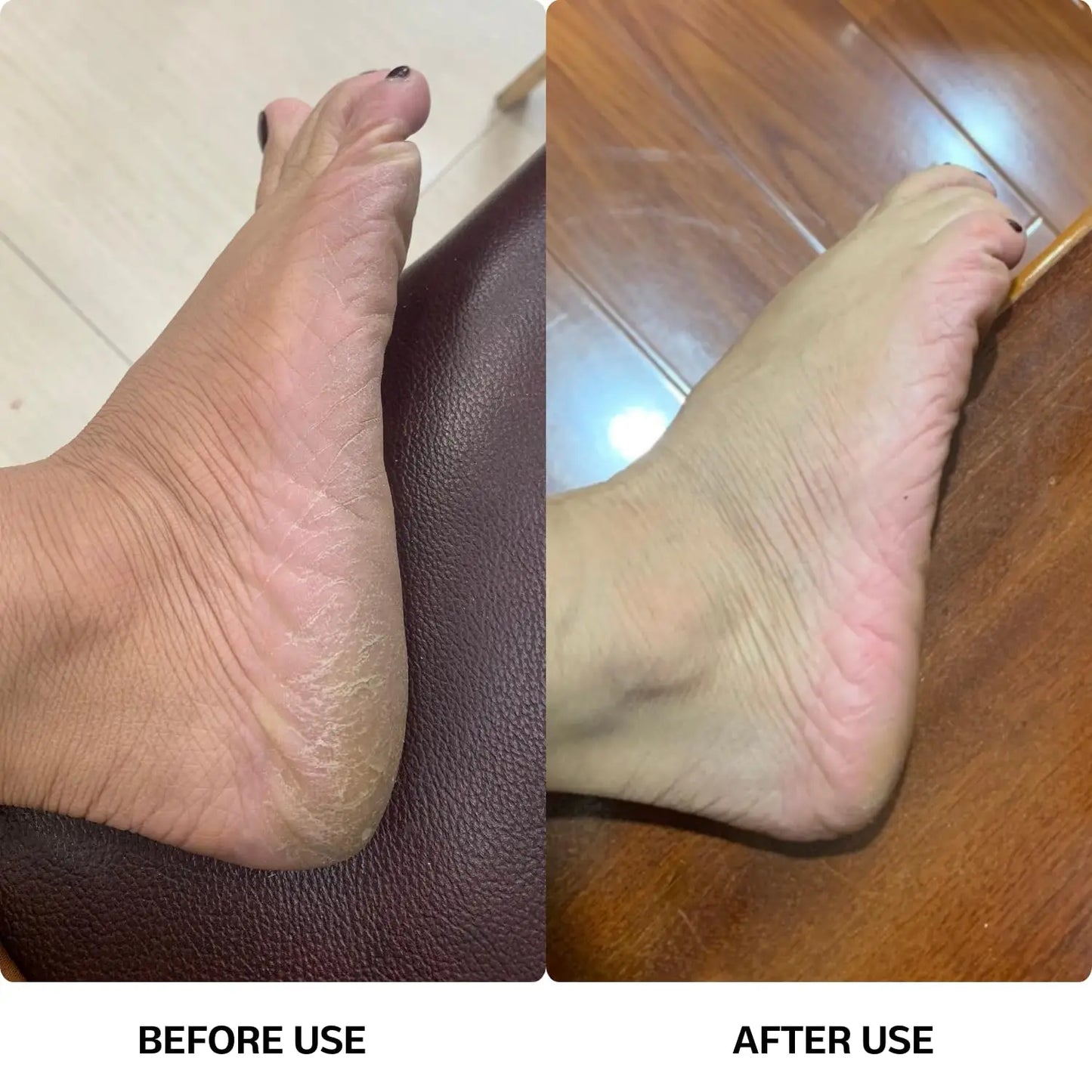 Electric Callus Remover with Speed Controller and 60pcs Replacement Sandpaper Disk for Men Women Dead Dry Crack Skin Calluses - Pape'sShop